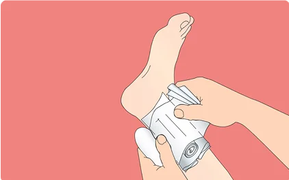 Illustrasjon av at man setter kompress på en ankel